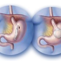 Heаlthy Life Clinic - Heаlthy Life Clinic