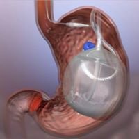 Heаlthy Life Clinic - Heаlthy Life Clinic