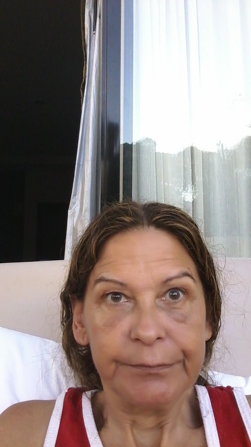 Healthy Skin Clinic Phuket - Healthy Skin Clinic Phuket