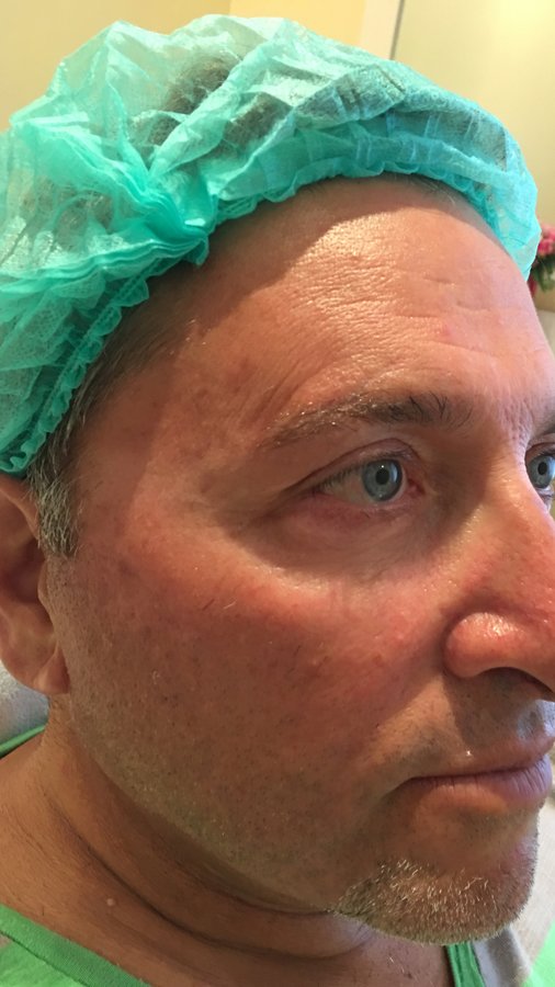 Healthy Skin Clinic Phuket - Healthy Skin Clinic Phuket