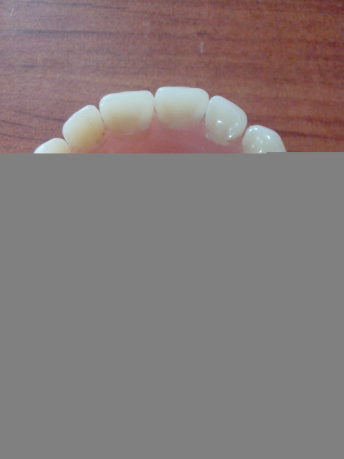 HEBRON DENTAL LABORATORY & CLINIC - HEBRON DENTAL LABORATORY & CLINIC
