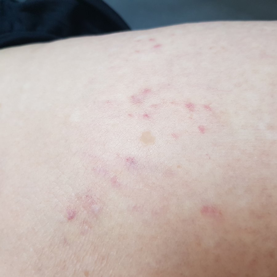 Hemel Cosmetic Clinic - Hemel Cosmetic Clinic