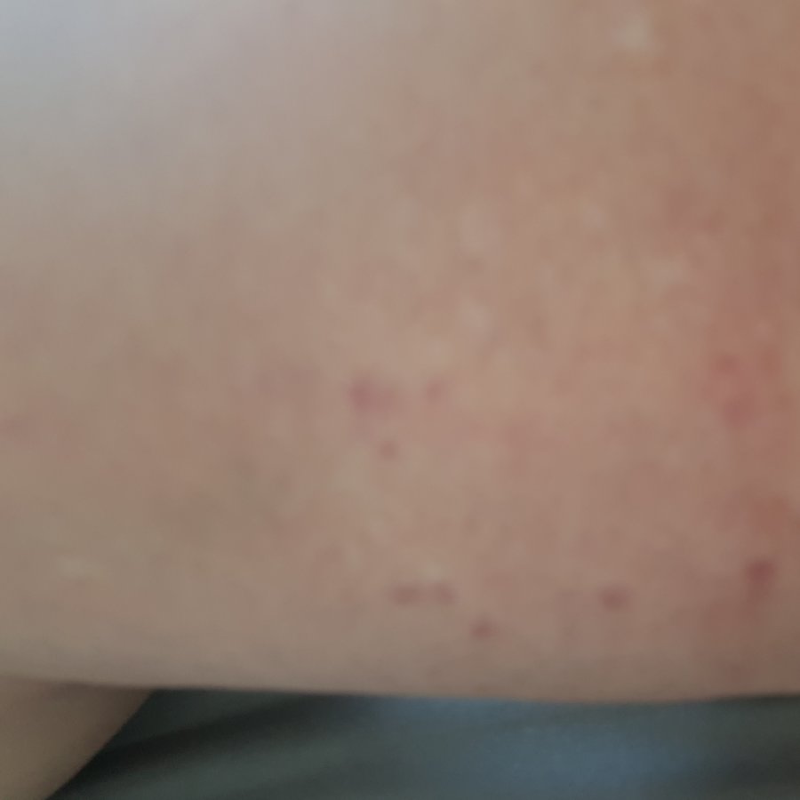 Hemel Cosmetic Clinic - Hemel Cosmetic Clinic