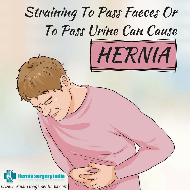 Hernia Surgery India - Hernia Surgery India