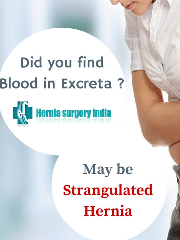 Hernia Surgery India - Hernia Surgery India
