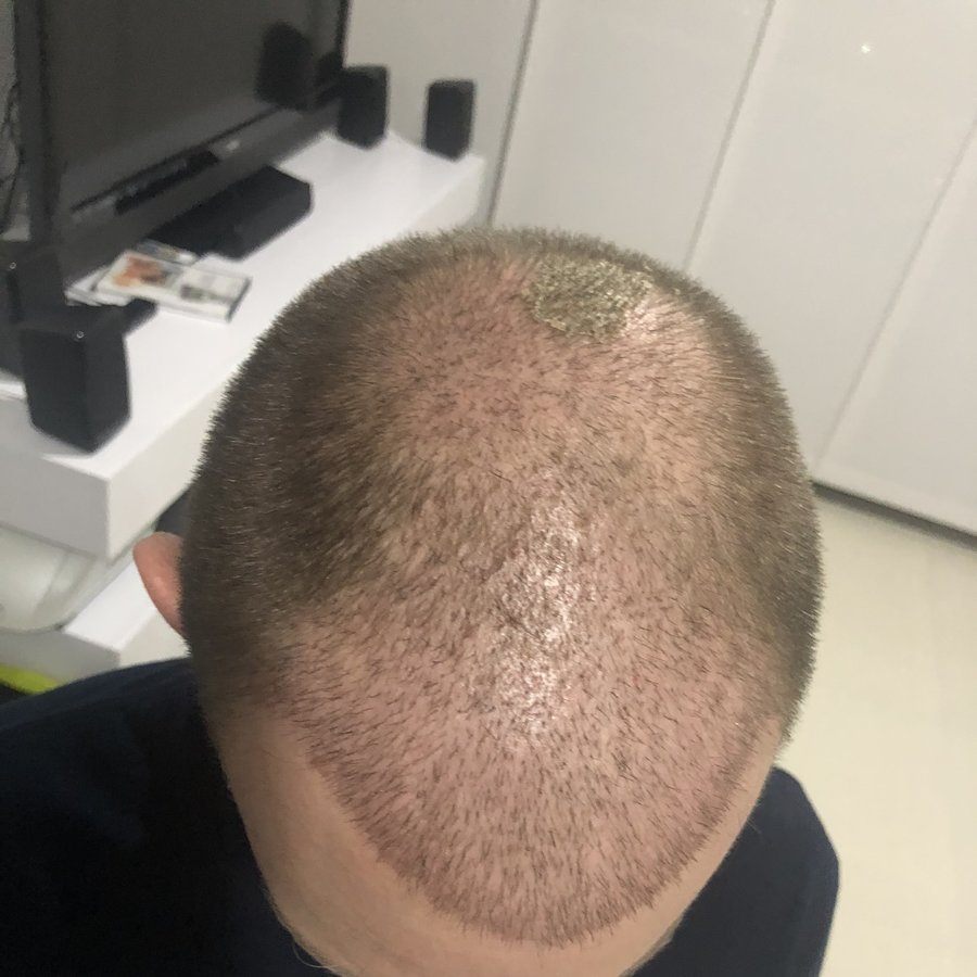 معهد هيرو للشعر - ميديلين - HERO Hair Institute - Medellín