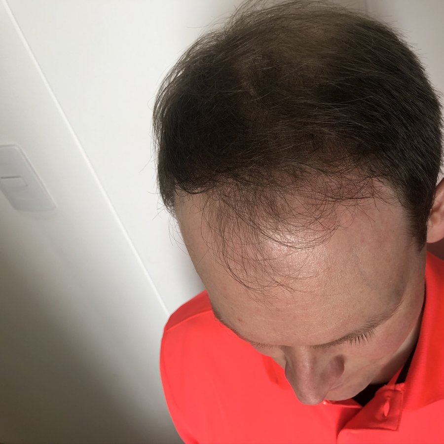 معهد هيرو للشعر - ميديلين - HERO Hair Institute - Medellín