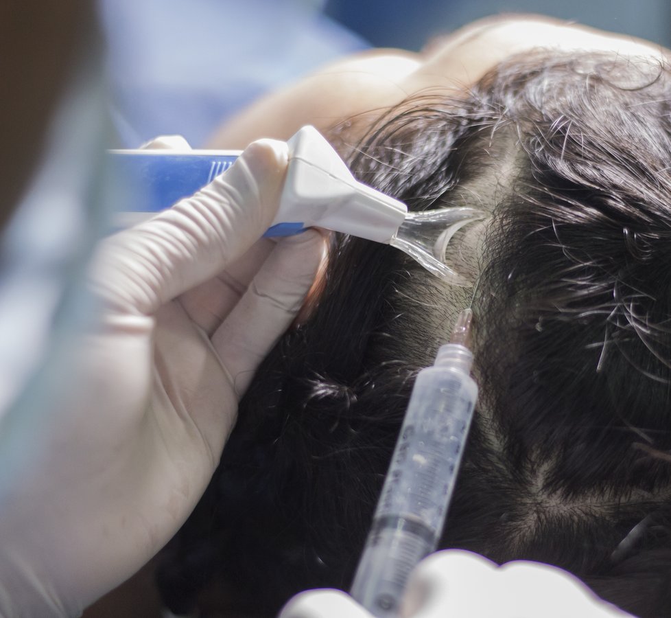 معهد هيرو للشعر - ميديلين - HERO Hair Institute - Medellín