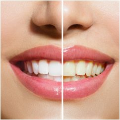 الأسنان عالية - High Dental