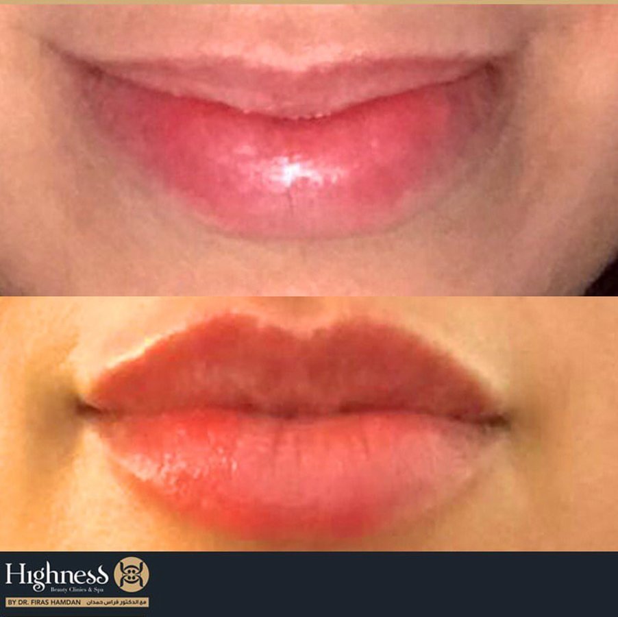 Highness Beauty Clinics & SPa - Highness Beauty Clinics & SPa