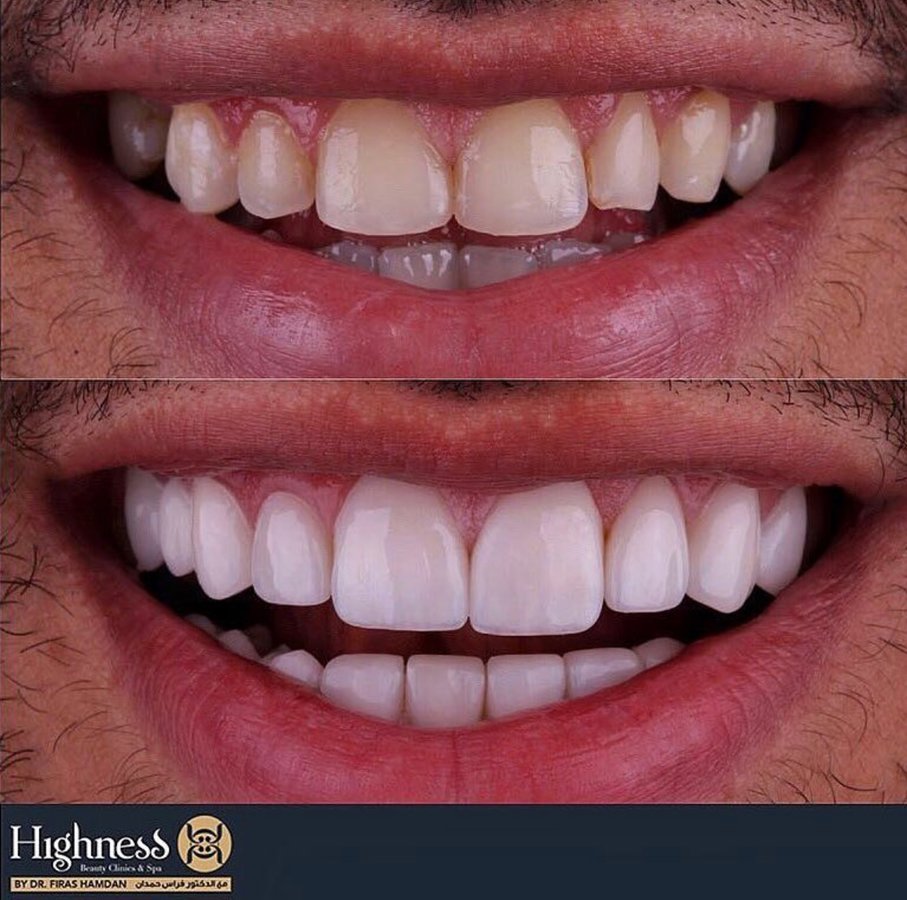 Highness Beauty Clinics & SPa - Highness Beauty Clinics & SPa