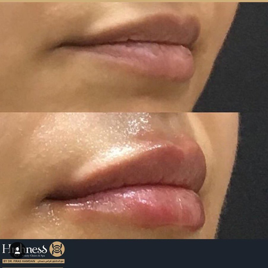 Highness Beauty Clinics & SPa - Highness Beauty Clinics & SPa