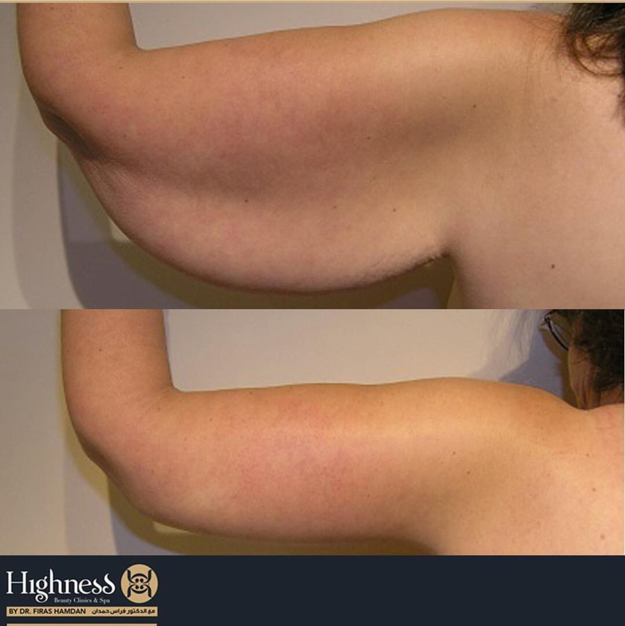 Highness Beauty Clinics & SPa - Highness Beauty Clinics & SPa