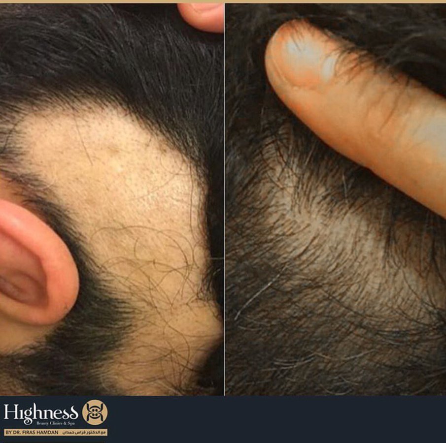 Highness Beauty Clinics & SPa - Highness Beauty Clinics & SPa