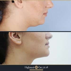 Highness Beauty Clinics & SPa - Highness Beauty Clinics & SPa