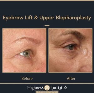 Highness Beauty Clinics & SPa - Highness Beauty Clinics & SPa