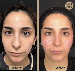 Highness Beauty Clinics & SPa - Highness Beauty Clinics & SPa