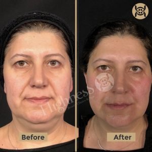 Highness Beauty Clinics & SPa - Highness Beauty Clinics & SPa