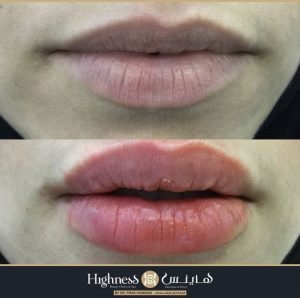 Highness Beauty Clinics & SPa - Highness Beauty Clinics & SPa