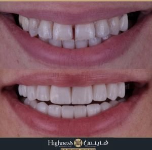 Highness Beauty Clinics & SPa - Highness Beauty Clinics & SPa