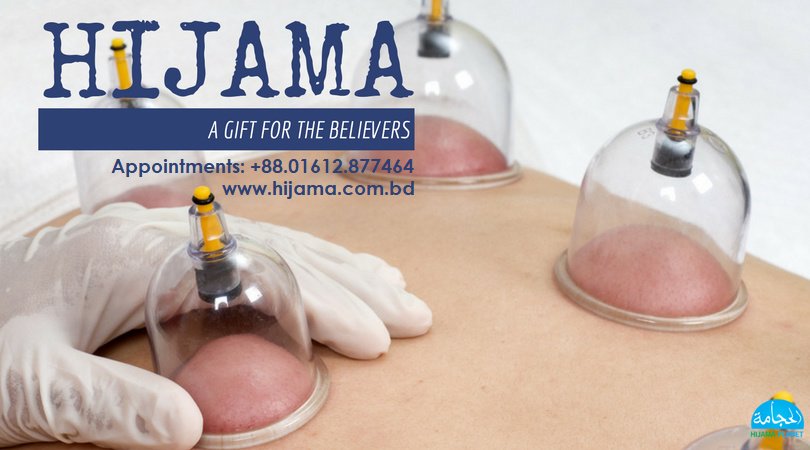 Hijama Planet: Cupping & Ruqyah Center - Hijama Planet: Cupping & Ruqyah Center