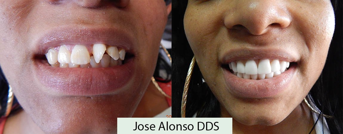 Hispadent - Jose Alonso MD, DDS, FACS - Hispadent - Jose Alonso MD, DDS, FACS