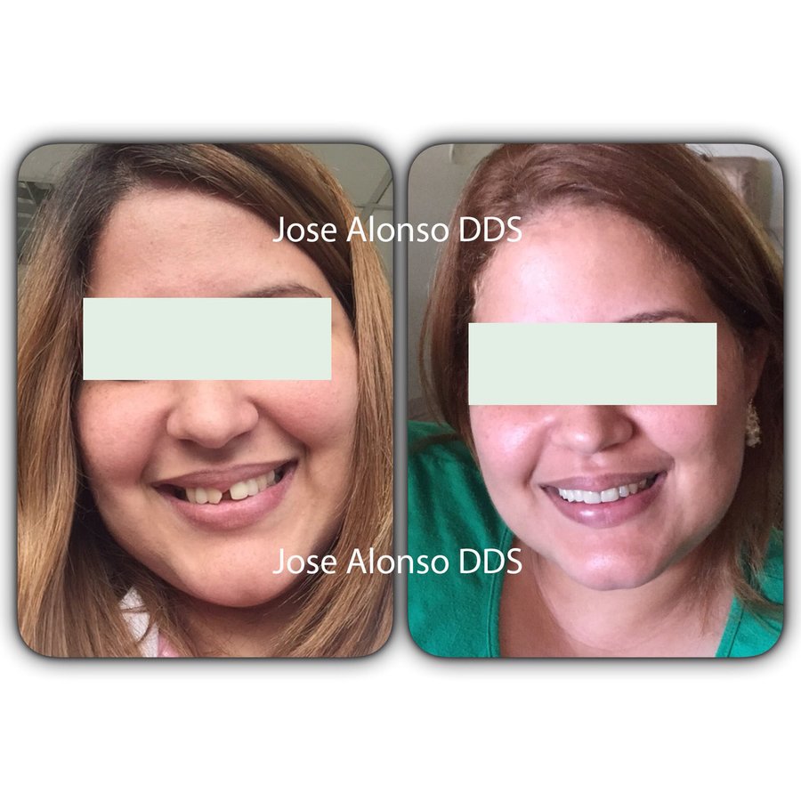 Hispadent - Jose Alonso MD, DDS, FACS - Hispadent - Jose Alonso MD, DDS, FACS