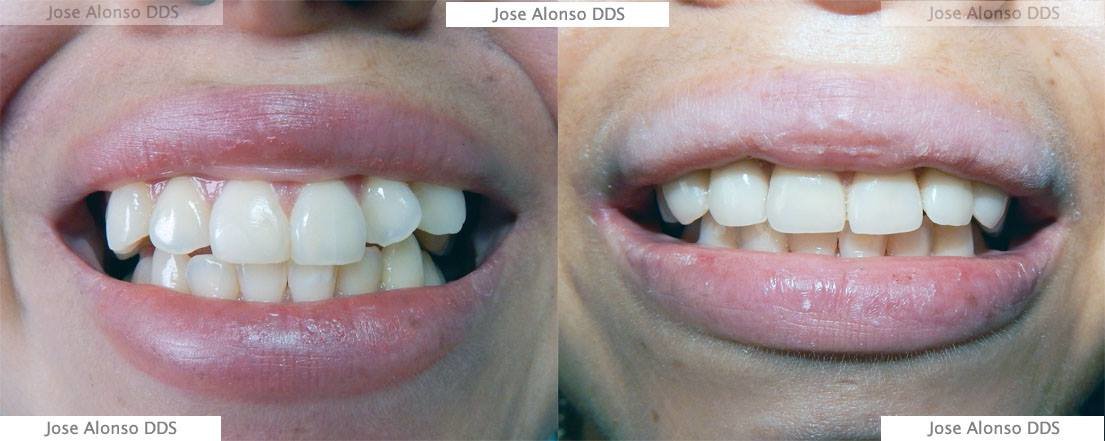 Hispadent - Jose Alonso MD, DDS, FACS - Hispadent - Jose Alonso MD, DDS, FACS