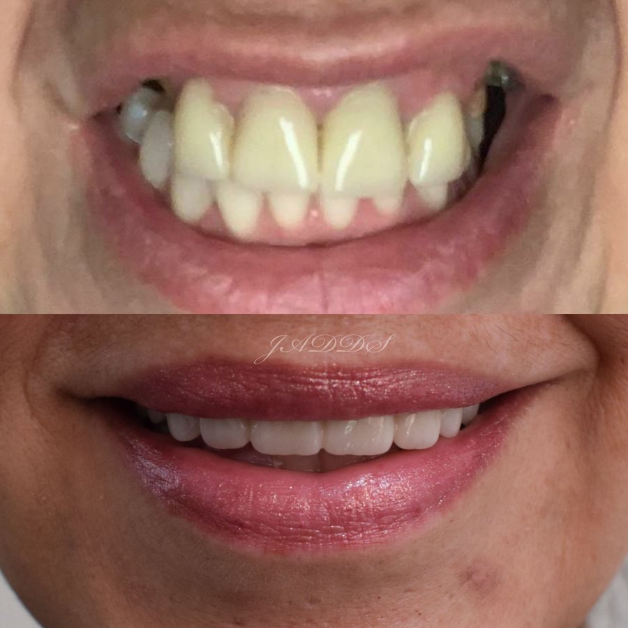 Hispadent - Jose Alonso MD, DDS, FACS - Hispadent - Jose Alonso MD, DDS, FACS