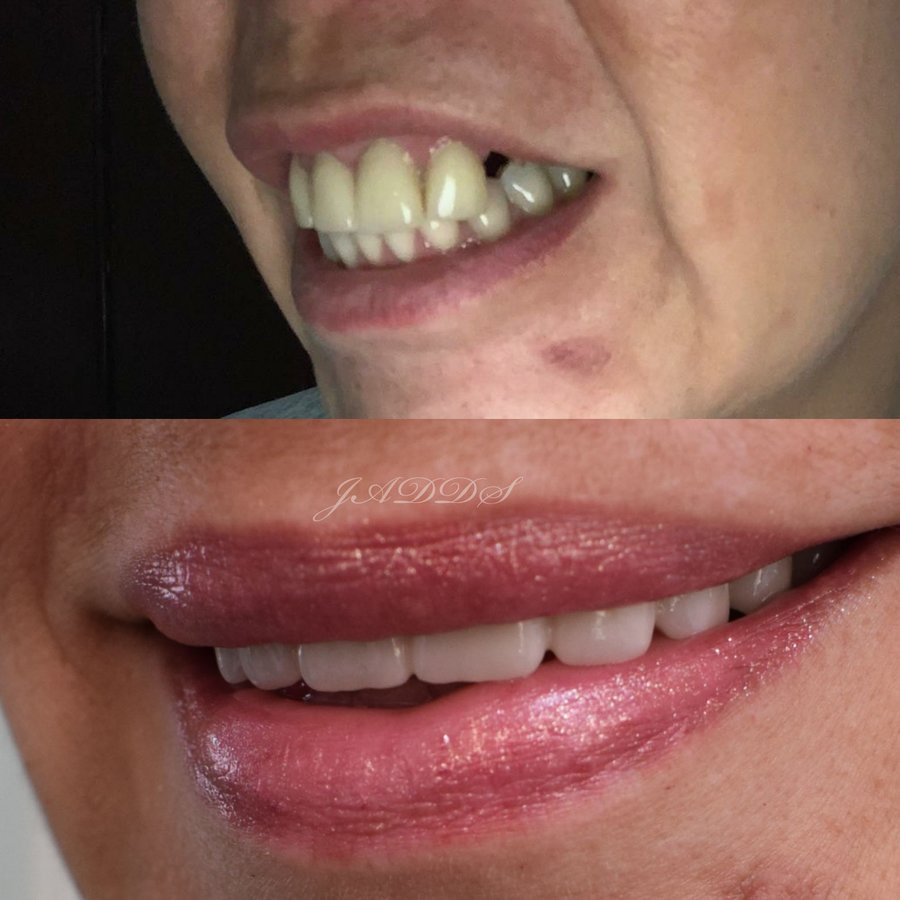 Hispadent - Jose Alonso MD, DDS, FACS - Hispadent - Jose Alonso MD, DDS, FACS