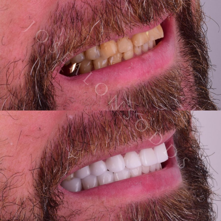 Hispadent - Jose Alonso MD, DDS, FACS - Hispadent - Jose Alonso MD, DDS, FACS