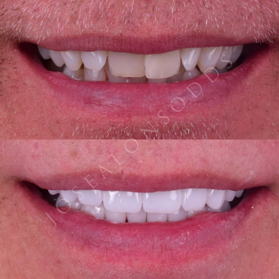 Hispadent - Jose Alonso MD, DDS, FACS - Hispadent - Jose Alonso MD, DDS, FACS