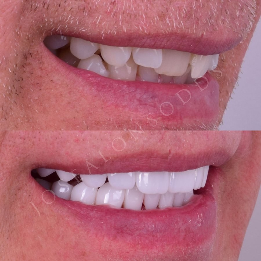 Hispadent - Jose Alonso MD, DDS, FACS - Hispadent - Jose Alonso MD, DDS, FACS