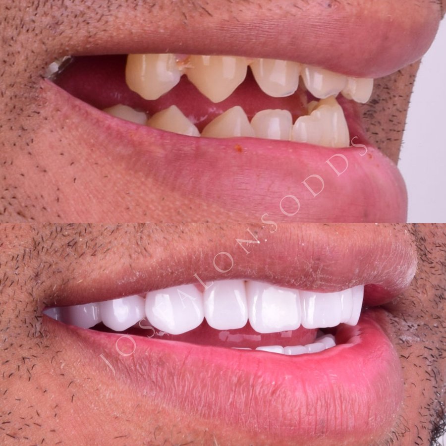 Hispadent - Jose Alonso MD, DDS, FACS - Hispadent - Jose Alonso MD, DDS, FACS