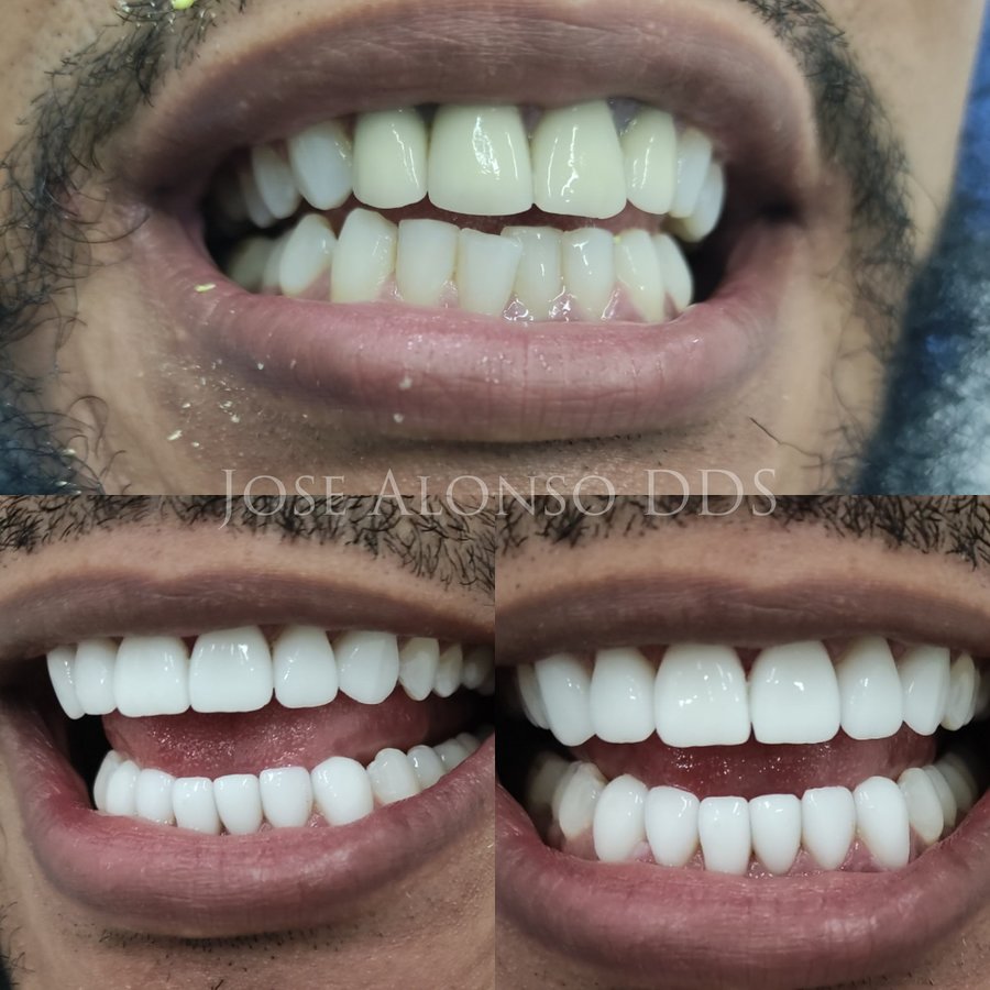 Hispadent - Jose Alonso MD, DDS, FACS - Hispadent - Jose Alonso MD, DDS, FACS