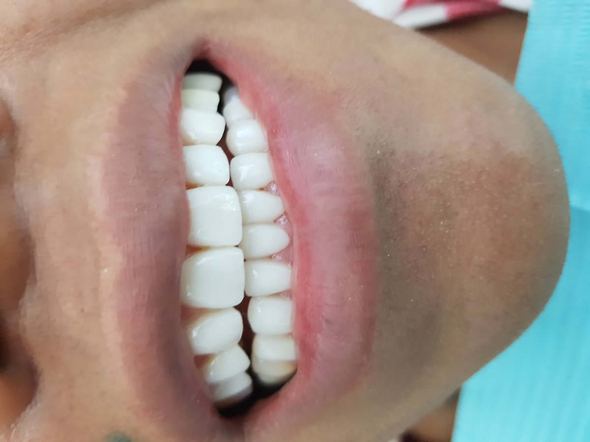 Hispadent - Jose Alonso MD, DDS, FACS - Hispadent - Jose Alonso MD, DDS, FACS