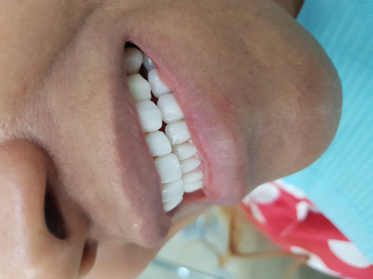 Hispadent - Jose Alonso MD, DDS, FACS - Hispadent - Jose Alonso MD, DDS, FACS