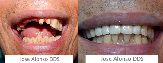 Hispadent - Jose Alonso MD, DDS, FACS - Hispadent - Jose Alonso MD, DDS, FACS