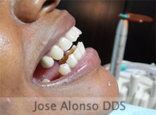 Hispadent - Jose Alonso MD, DDS, FACS - Hispadent - Jose Alonso MD, DDS, FACS