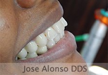 Hispadent - Jose Alonso MD, DDS, FACS - Hispadent - Jose Alonso MD, DDS, FACS