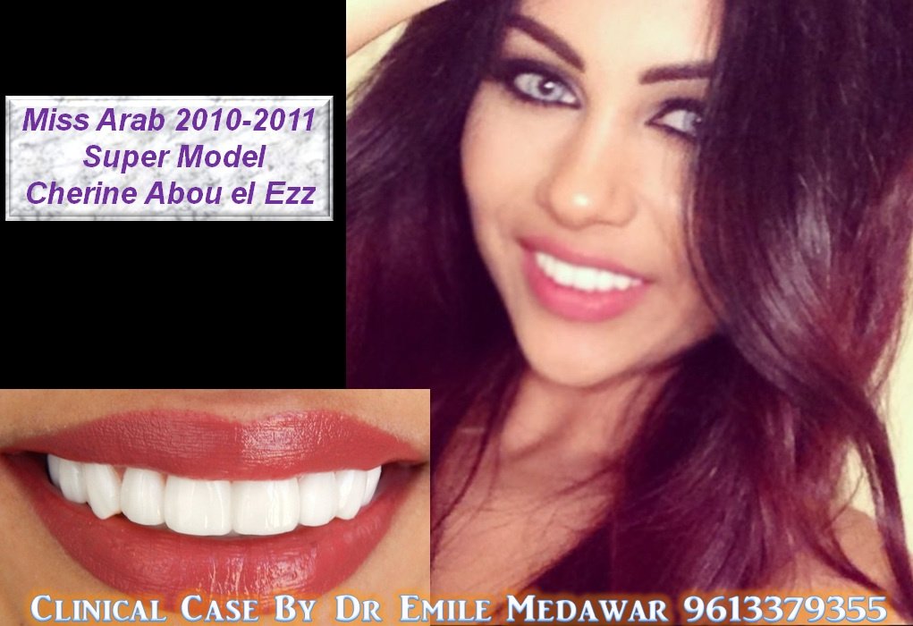 Hollywood Smile Clinic - Cork Street - Hollywood Smile Clinic - Cork Street