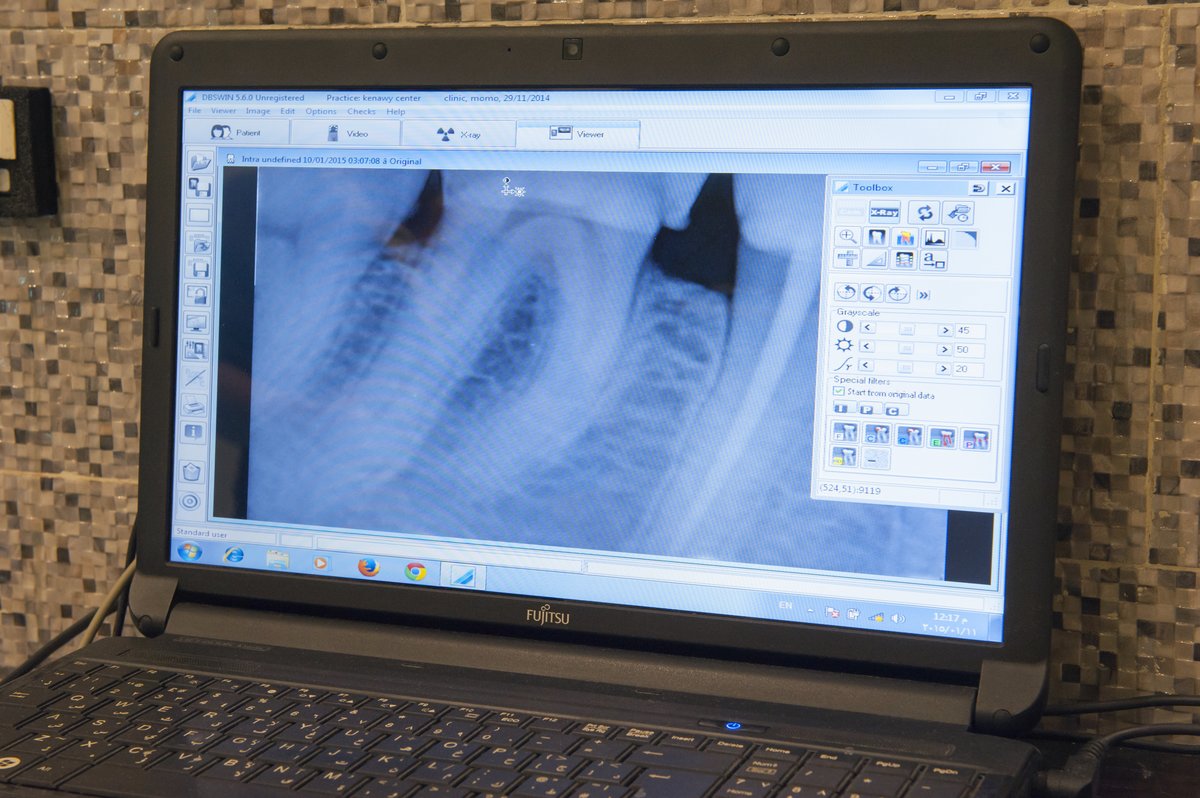 Hollywood Smile Dental center - Hollywood Smile Dental center