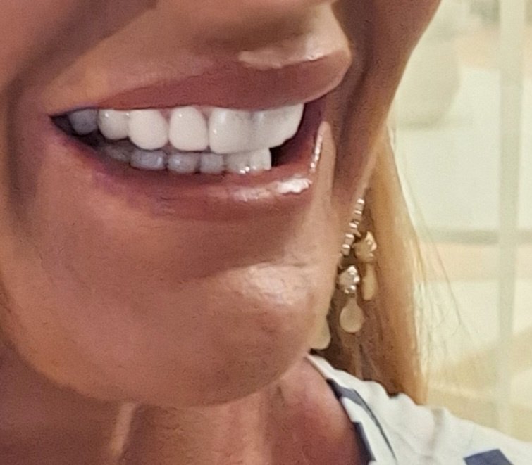 HSmile Dental Clinic - HSmile Dental Clinic