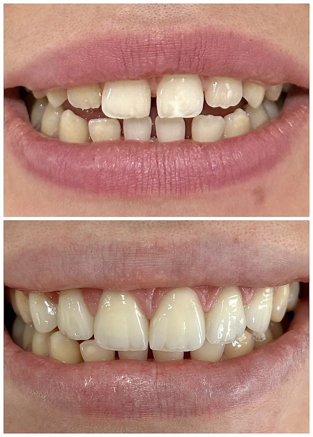 HSmile Dental Clinic - HSmile Dental Clinic