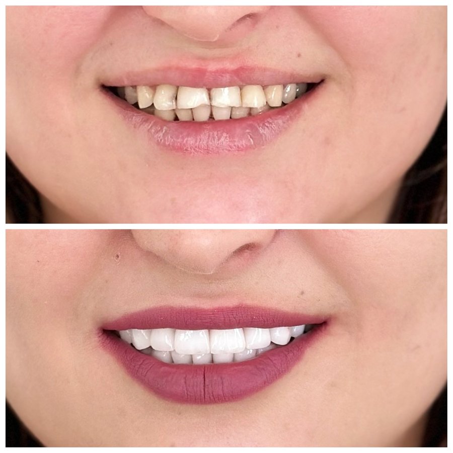 HSmile Dental Clinic - HSmile Dental Clinic