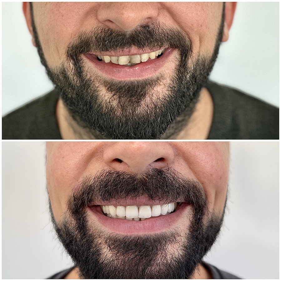 HSmile Dental Clinic - HSmile Dental Clinic