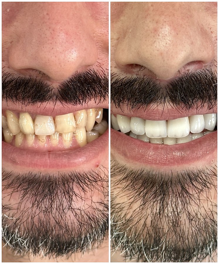 HSmile Dental Clinic - HSmile Dental Clinic