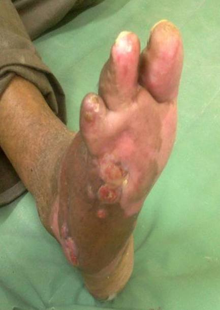 Iaso's Advanced Wound Management Centre - Iaso's Advanced Wound Management Centre