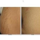 مركز ايكونيك الطبي للجلد والليزر - Iconic Medical Skin and Laser Center