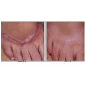 مركز ايكونيك الطبي للجلد والليزر - Iconic Medical Skin and Laser Center